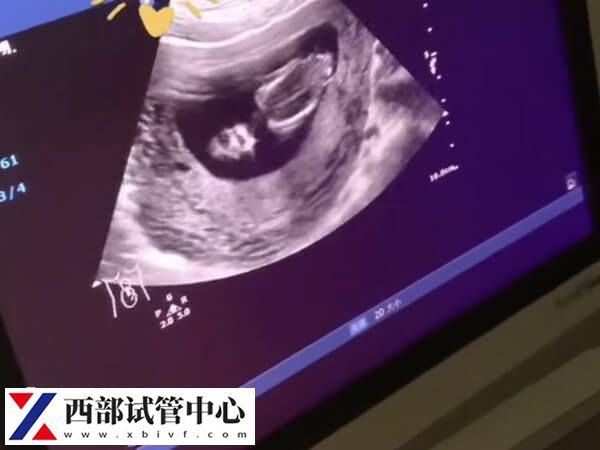 能不能選擇彩超來檢查卵泡是否破裂