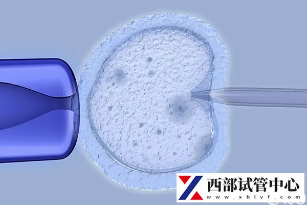 不同輔助生殖技術臨床妊娠率不一樣